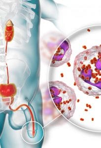 Image de Maladies Vénériennes