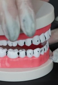 Image de Maladies Dentaires