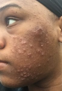 Image de Maladies Cutanées